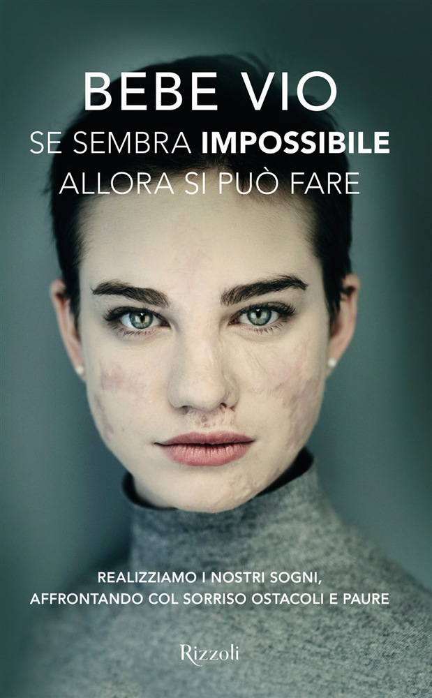 Beatrice Vio